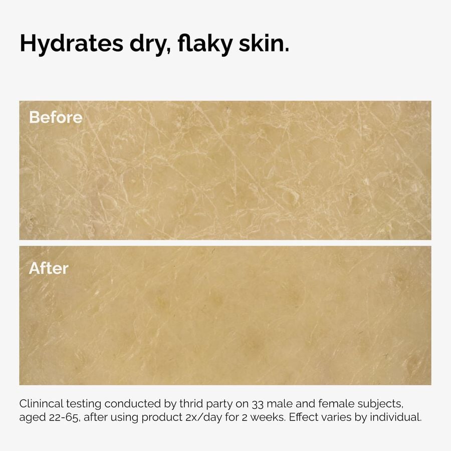 the-body-care-collection-g2 ord-natural-moisturizing-factors-inulin-body-before-after-graphic-02.jpg