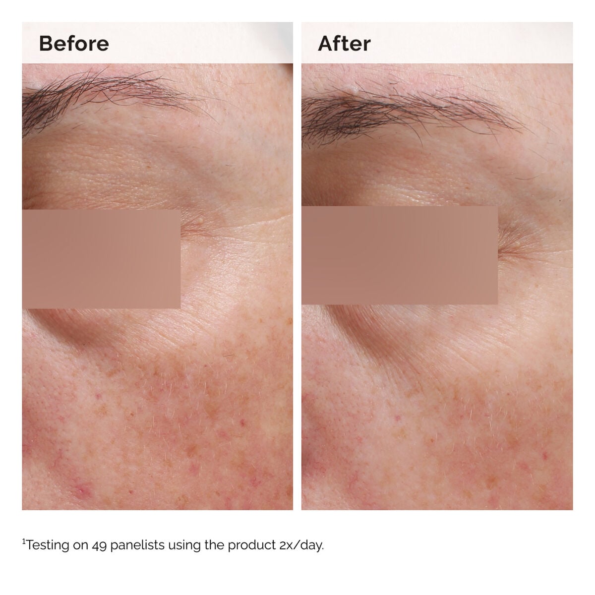 niacinamide-5-face-and-body-emulsion-f0 2024-08-23-ORD-Nia-5pct-Face-Body-B-A-Elasticity-Global-02-1x1.jpg