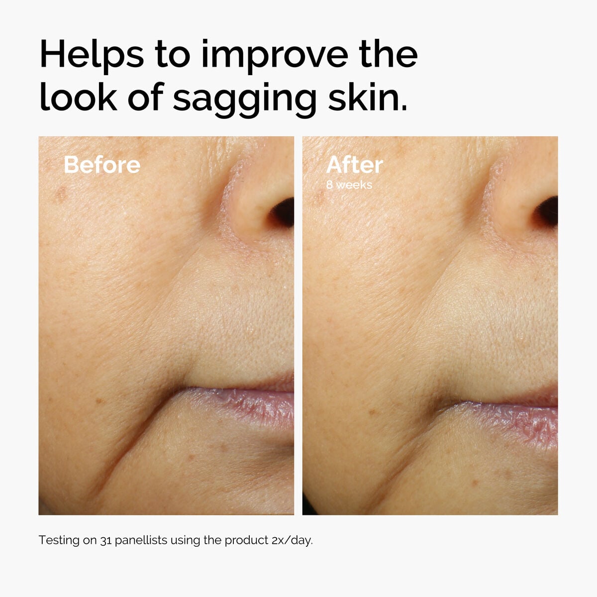 caffeine-3-escin-1-face-serum-g3 ord-caffeine-3pct-escin-1pct-face-serum-before-after-sagging.jpg