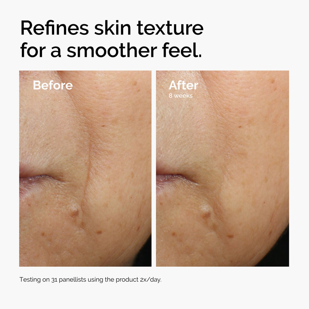 caffeine-3-escin-1-face-serum-g3 ord-caffeine-3pct-escin-1pct-face-serum-before-after-texture.jpg