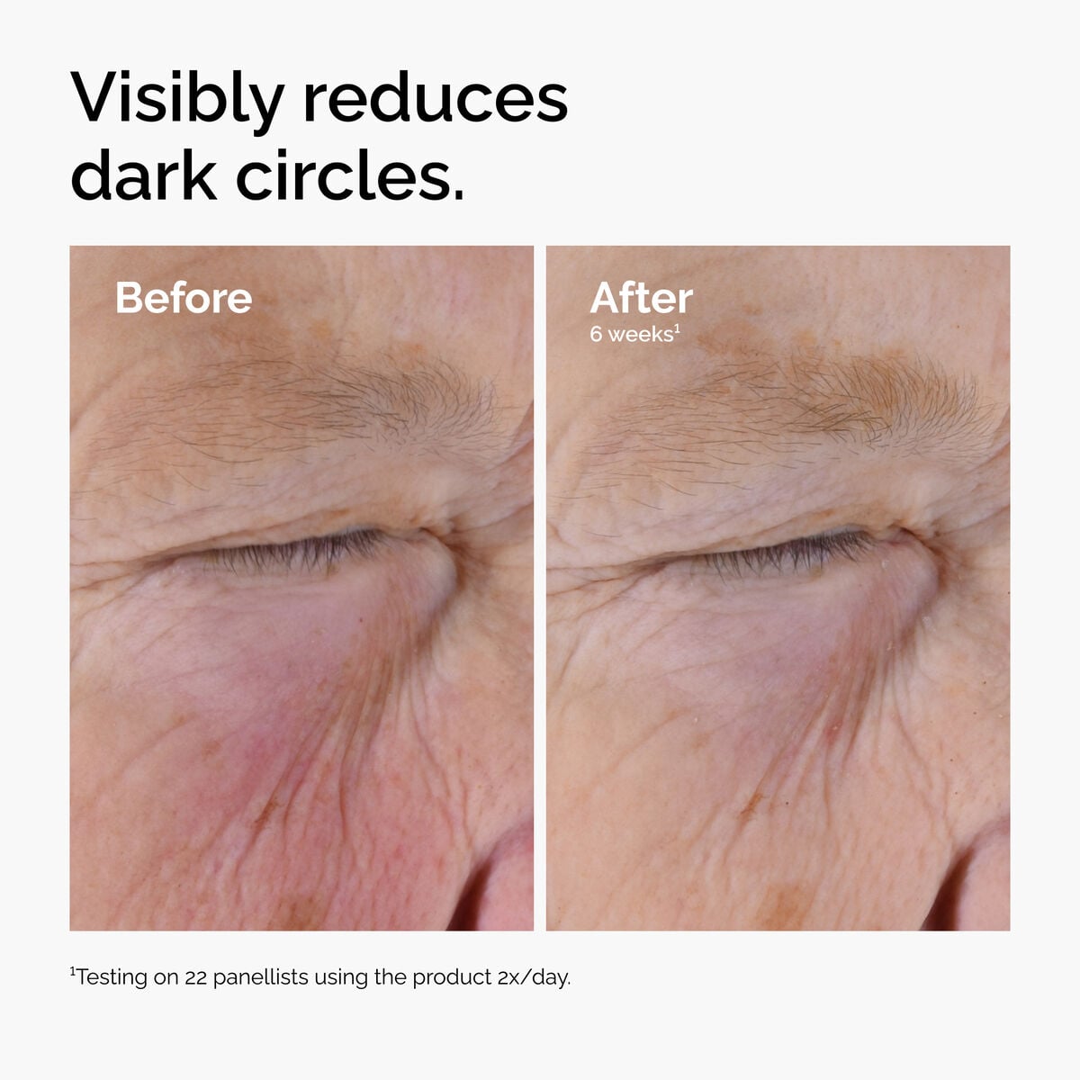 caffeine-solution-5-egcg-eye-serum-j5 ord-caffeine-solution-egcg-dark-circles-before-after.jpg