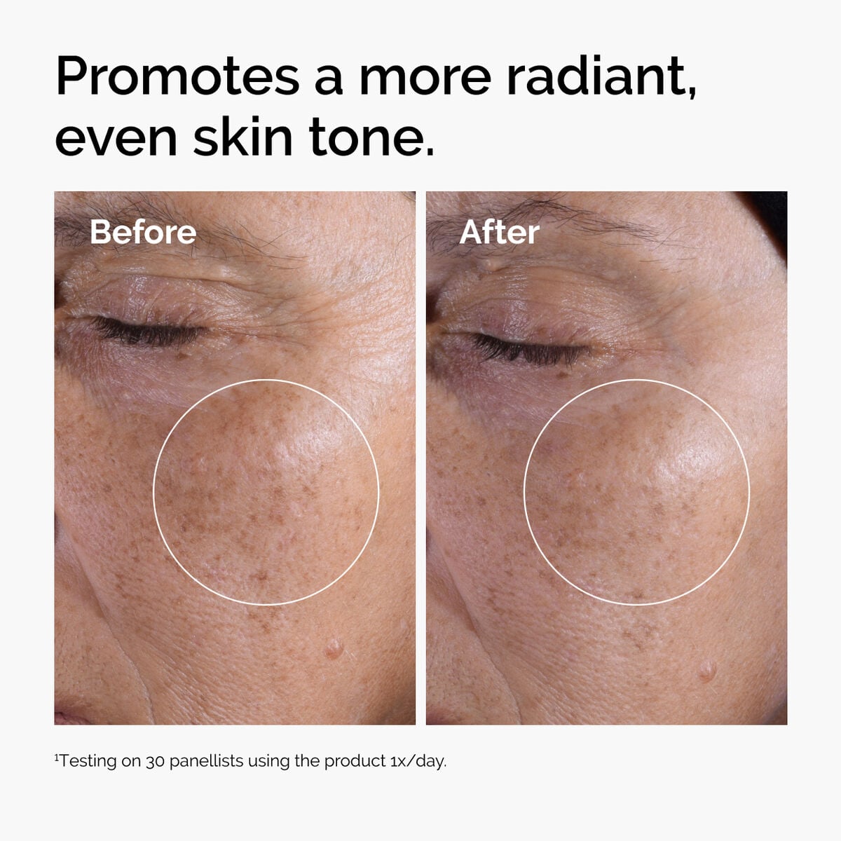 glycolic-acid-7-exfoliating-toner-g5 ord-glycolic-before-after-radiance.jpg