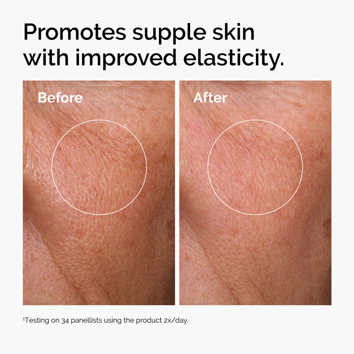 hyaluronic-acid-2-b5-with-ceramides-z5 ord-hyaluronic-acid-2pct-b5-hydrating-serum-before-after-elasticity.jpg