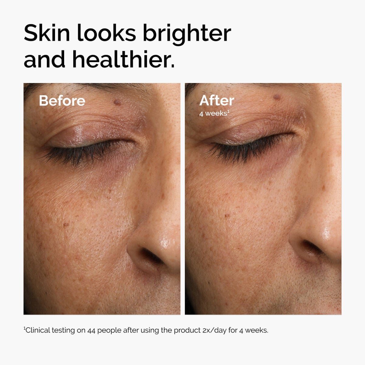 multi-antioxidant-radiance-serum-b2 ord-mars-before-after-healthy.jpg