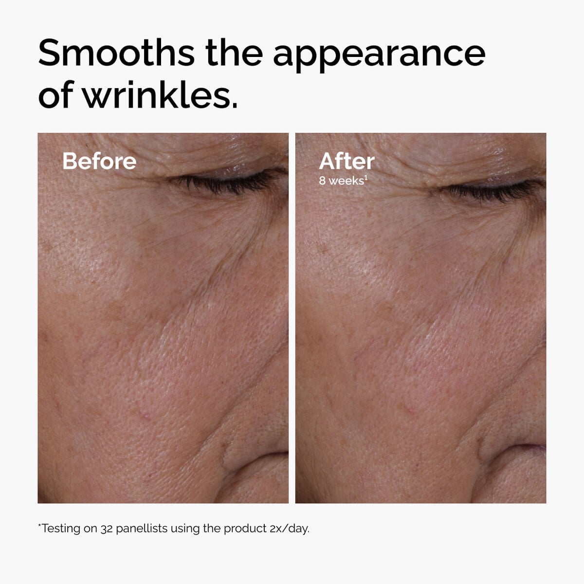 multi-peptide-ha-serum-d6 ord-multi-peptide-ha-serum-wrinkles-before-after.jpg