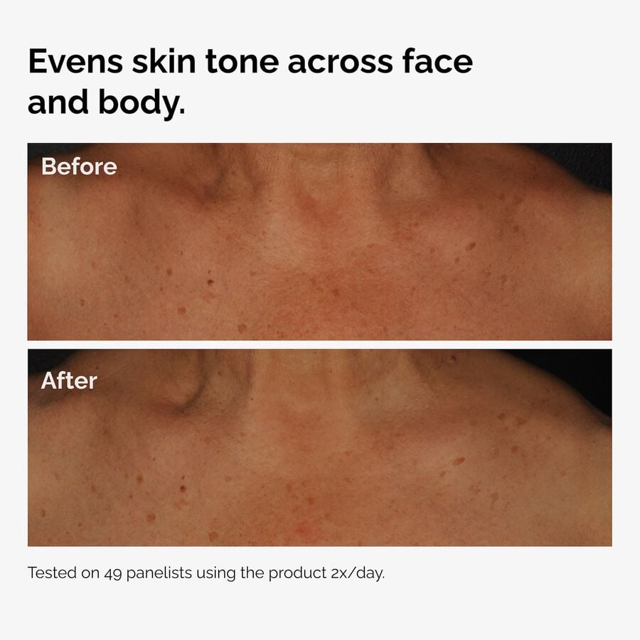 the-body-care-collection-g2 ord-niacinamide-face-body-serum-before-after-even-tone-graphic.jpg