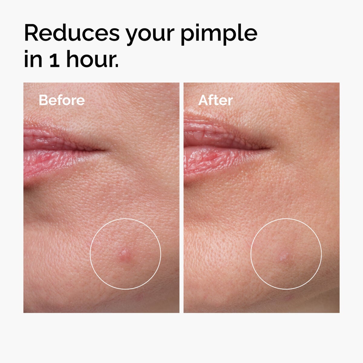 sulfur-10-powder-to-cream-concentrate-l5 ord-sulfur-10pct-powder-to-cream-concentrate-before-after-NA.jpg